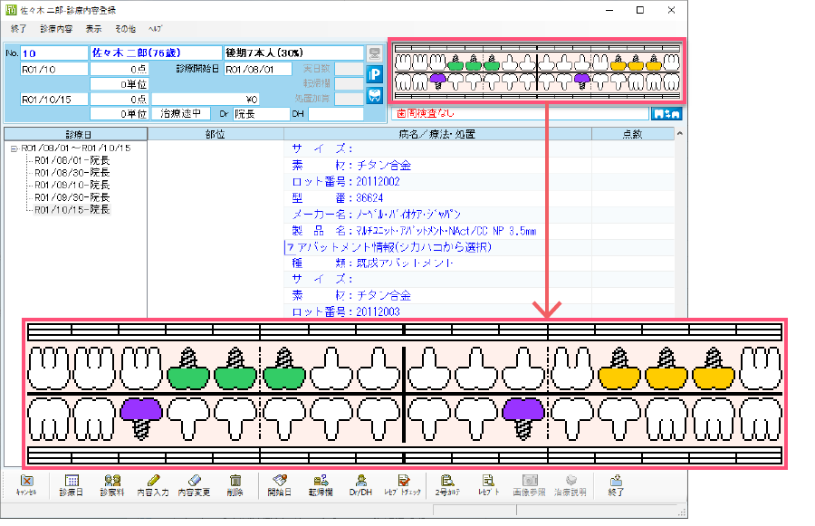 20200318implant03.png