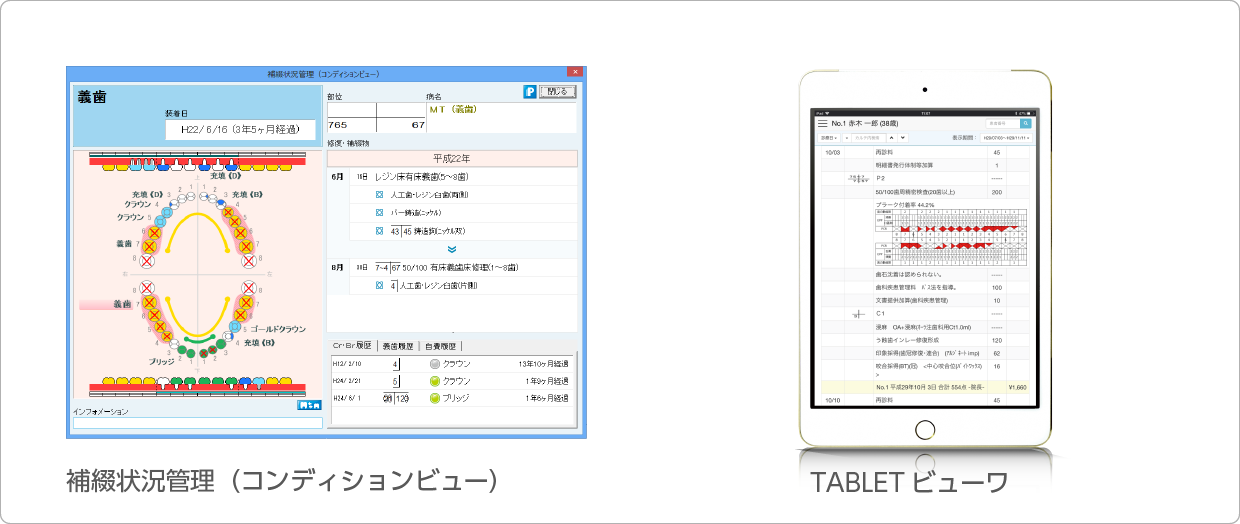 歯科レセコンの活用のポイント:補綴状況管理（コンディションビュー）とTABLETビューワ